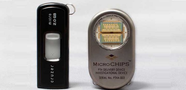 microchip inyecciones